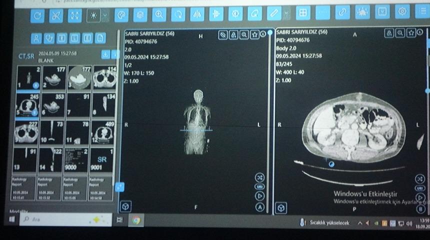 Van'dan dünyaya örnek çalışma: Kanser tedavisinde yapay zekâ kullanıldı
