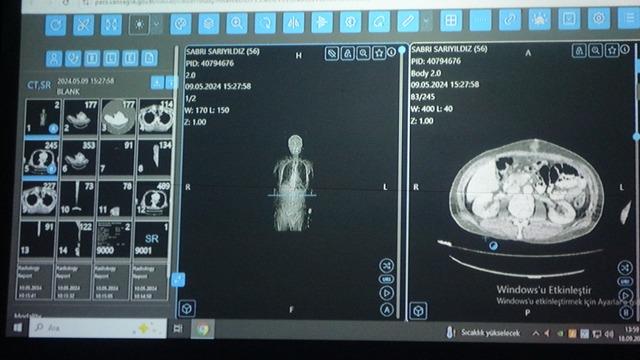 Van'dan dünyaya örnek çalışma: Kanser tedavisinde yapay zekâ kullanıldı