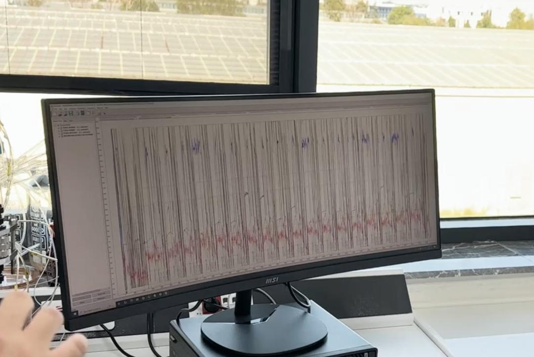Sağlık Bakanlığı Kemal Memişoğlu duyurdu: İlk yerli SMA ilacı müjdesi! 6