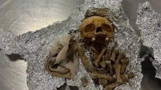 Ritüel yapacakmış: Valizinden insan kemikleri ve kafa tası çıktı! Havalimanında kan donduran görüntü