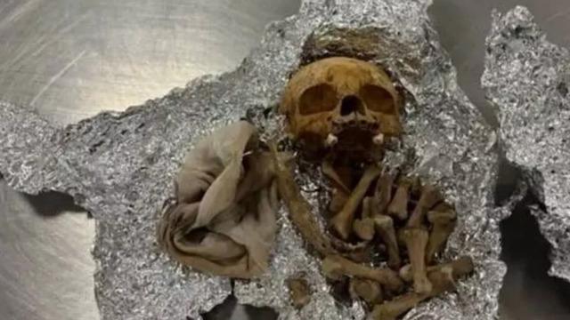 Ritüel yapacakmış: Valizinden insan kemikleri ve kafa tası çıktı! Havalimanında kan donduran görüntü