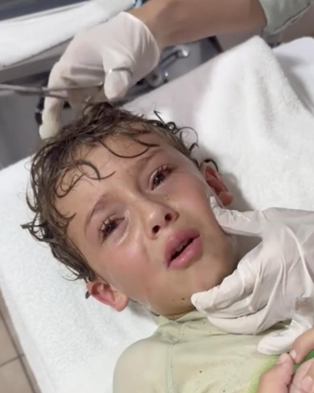 Kulağından canlı yengeç çıktı! Annesi sosyal medya fenomeni: Oğlunun tatili kabusa dönüştü! Görenler inanamadı… 2