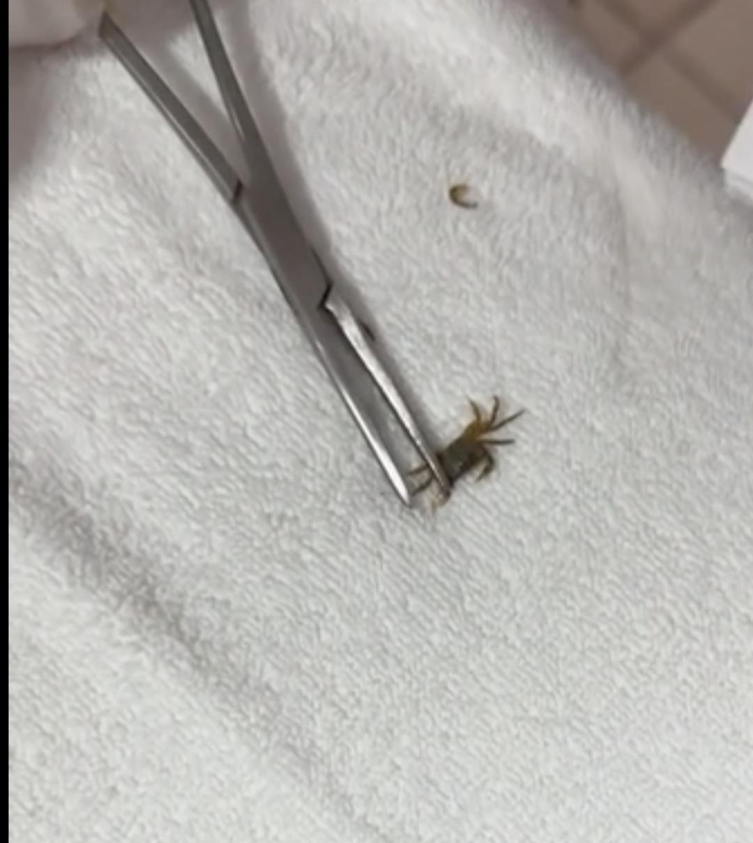 Kulağından canlı yengeç çıktı! Annesi sosyal medya fenomeni: Oğlunun tatili kabusa dönüştü! Görenler inanamadı… 3