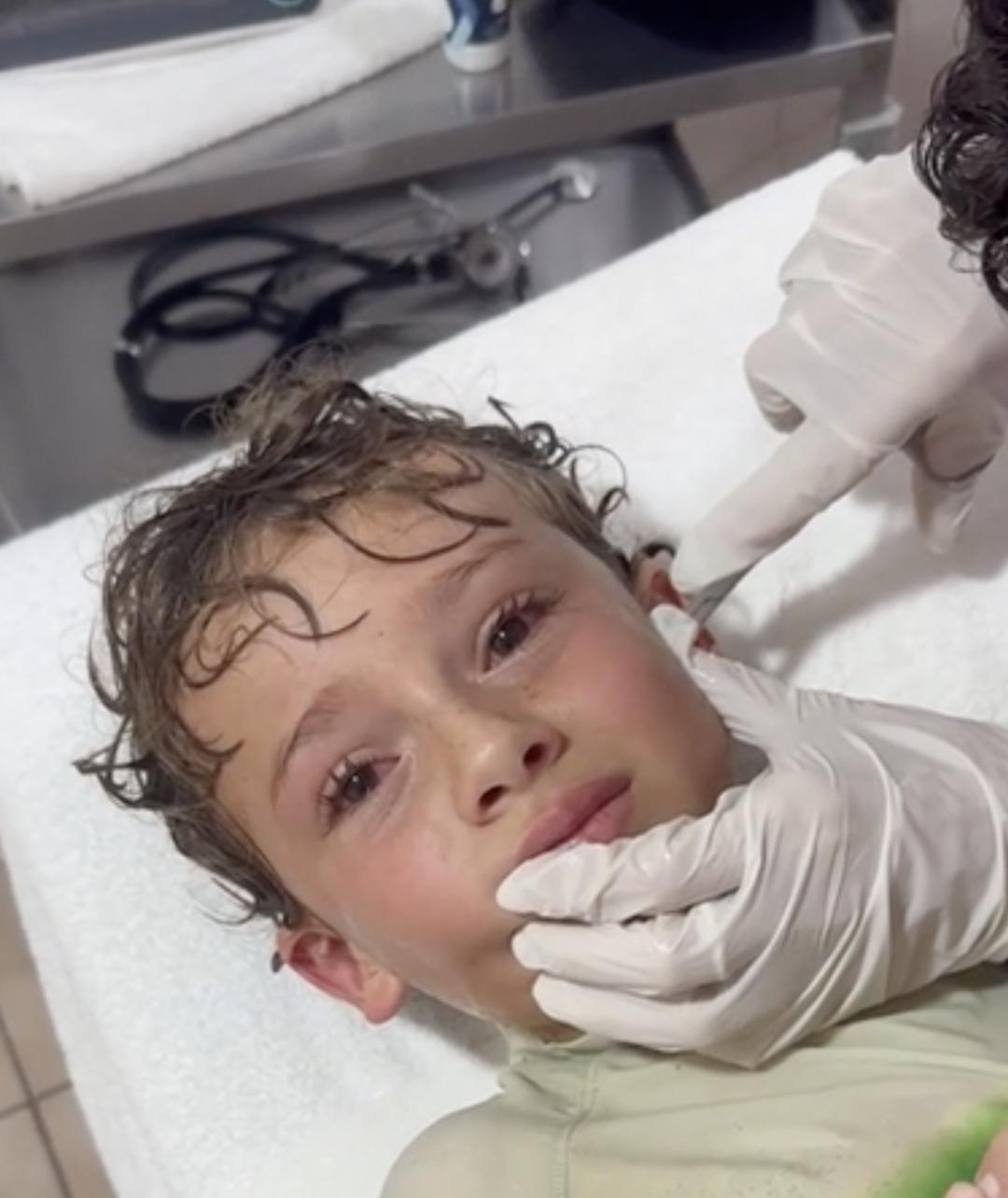 Kulağından canlı yengeç çıktı! Annesi sosyal medya fenomeni: Oğlunun tatili kabusa dönüştü! Görenler inanamadı… 4