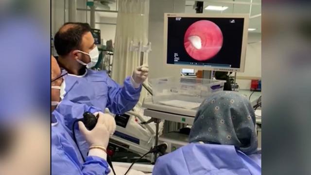 Yemek yerken ölümle burun buruna geldi! Akciğerine sarımsak kaçtı!