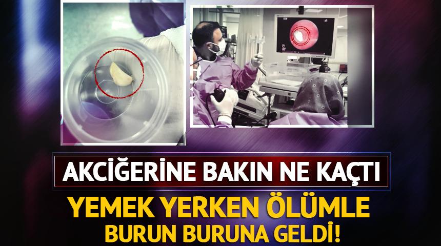 Akciğerine sarımsak kaçtı!
