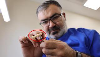 Özel kliniklerde 8 bin TL’ye yapılıyordu, devlet hastanelerinde 188 TL’ye yapılmaya başlandı