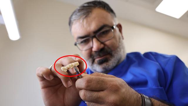 Özel kliniklerde 8 bin TL’ye yapılıyordu, devlet hastanelerinde 188 TL’ye yapılmaya başlandı