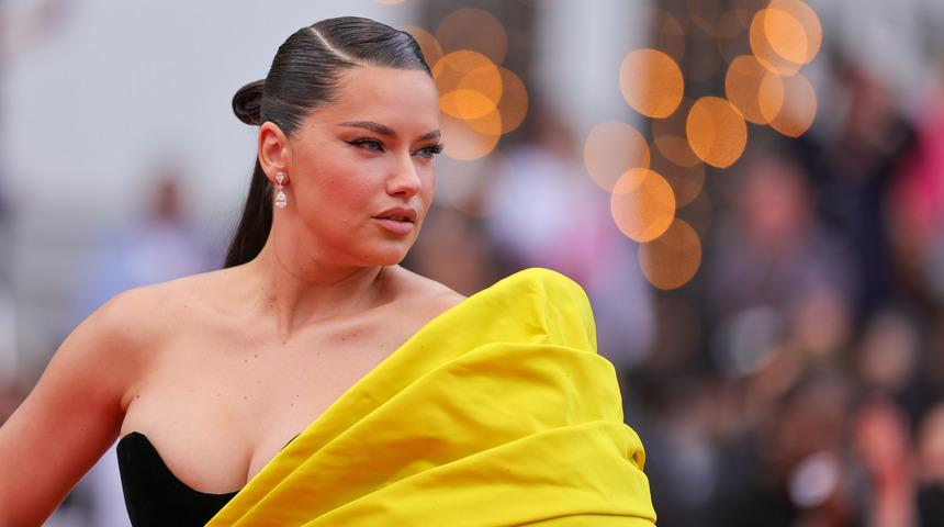 Adriana Lima yüz yağlarını aldırdı! Son hali gündemde