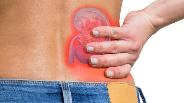 Böbrek taşı sadece yetişkinlerin sorunu değil: Her yaşta görülebilir! Uzmanlar risklere karşı uyardı...