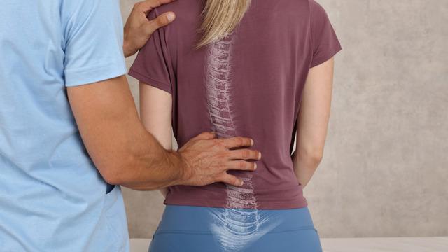 Duruş bozuklukları nasıl düzeltilir? Gençlerde duruş bozukluklarını düzeltme egzersizleri 