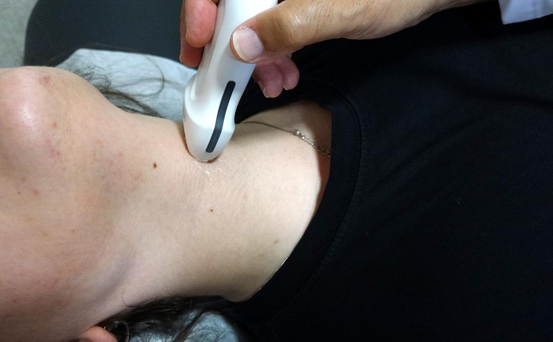 Kadınlarda daha sık görülen bu hastalıkta korkutan durum! Tiroit nodüllerinde artış: "En yaygın nedeni iyot eksikliği" 1