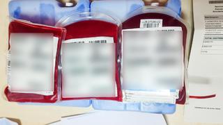 Türkiye'de bir ilk! 'Altın kan' İspanya'dan getirildi... 6 milyonda bir görülüyor