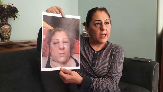 Ankara'da 'kedi besleme' kavgası... Talihsiz kadını öldüresiye darp ettiler: O anlar kamerada!