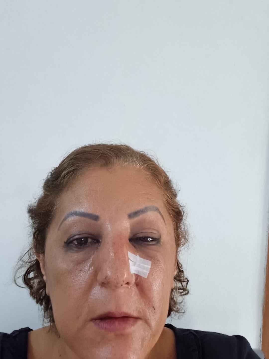 Ankara da kedi besleme kavgası... Talihsiz kadını öldüresiye darp ettiler: O anlar kamerada! 2