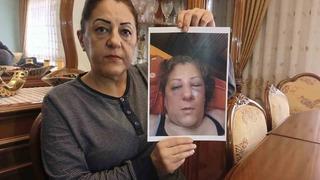 Apartman bahçesinde beslediği kediler nedeniyle komşuları tarafından darbedilen kadının burnu kırıldı