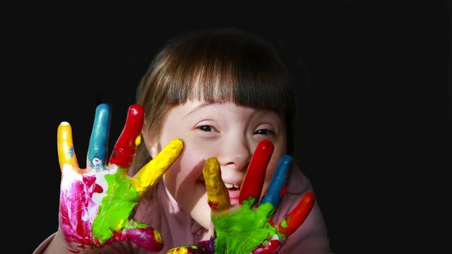 Down sendromu nedir, nasıl anlaşılır?