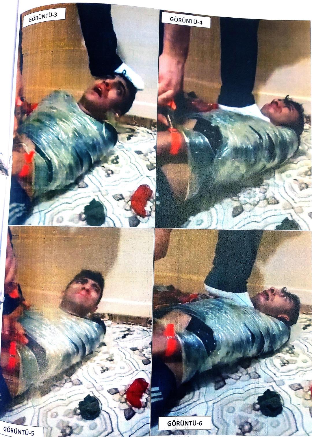 Akılalmaz işkence! 20 kişi gelip linç ettiler: Her iki dizime çekiçle vurdular, dilimi penseyle çektiler 1