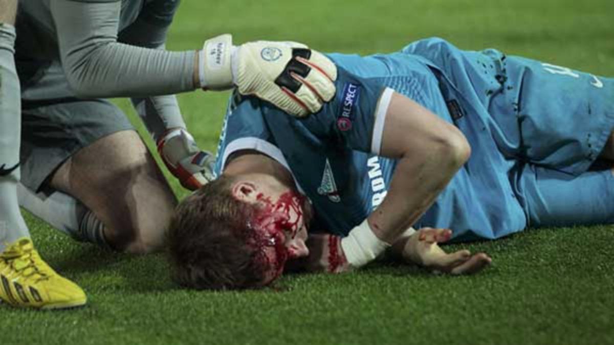 Zenitli Tomas Hubocan korkuttu!