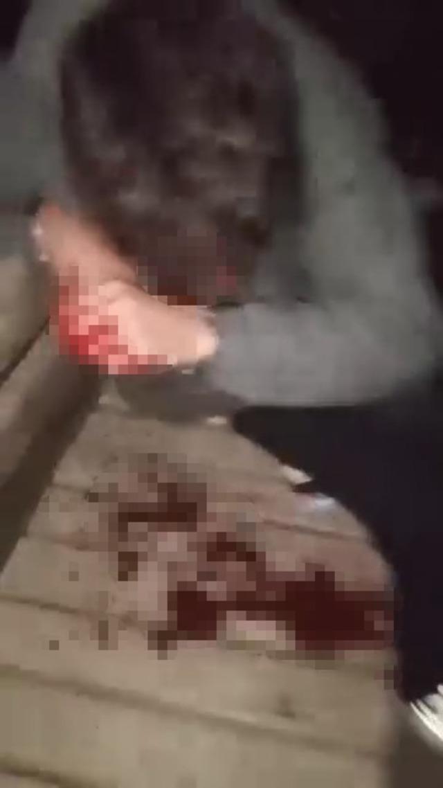 Çanakkale’de kız meselesi yüzünden tartıştığı kişiyi darbeden şüpheli tutuklandı 1