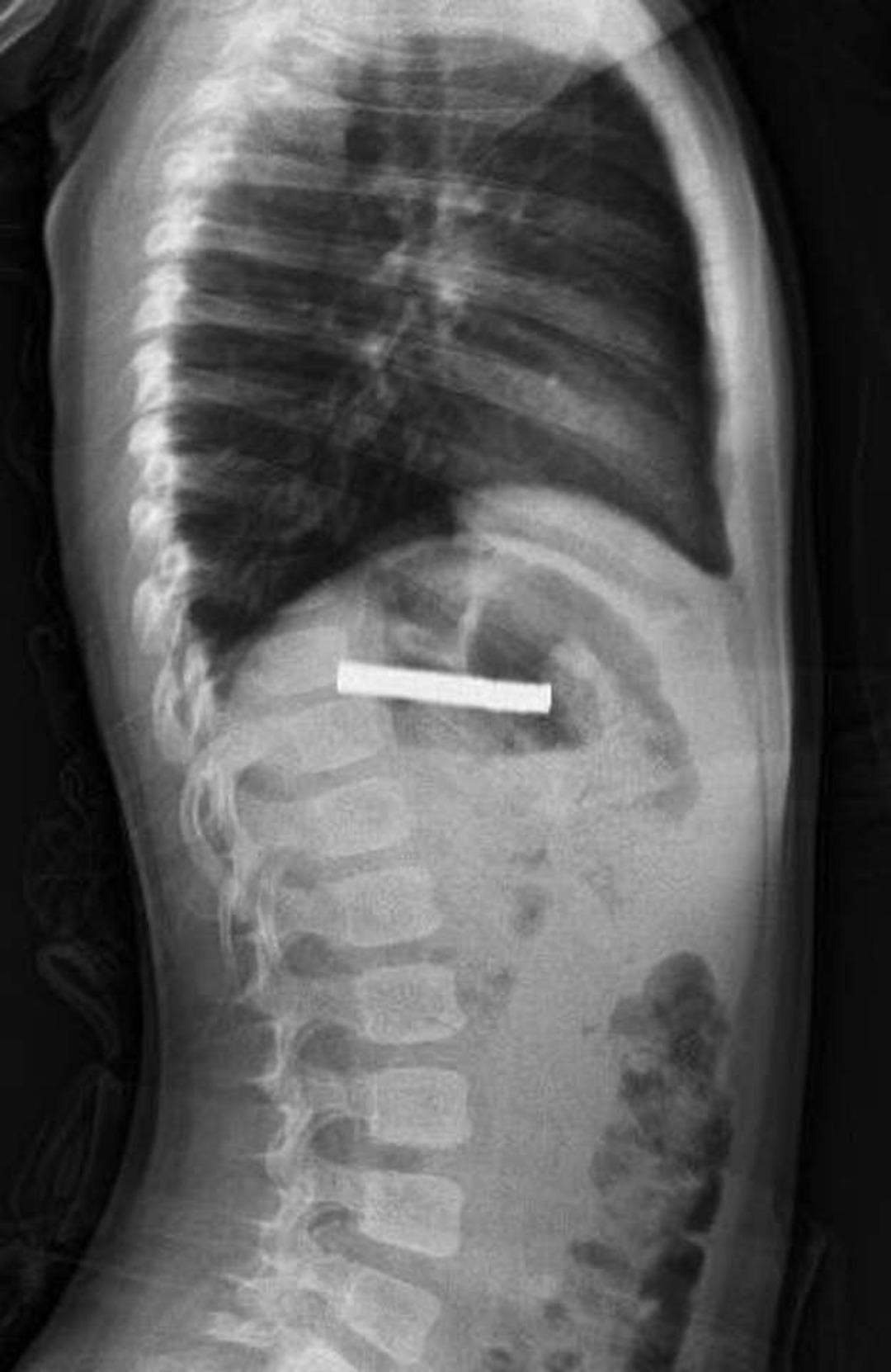 Hepsi boğazından çıktı: Tam 19 tane! Aman dikkat... Çocuklardan uzak tutun 2