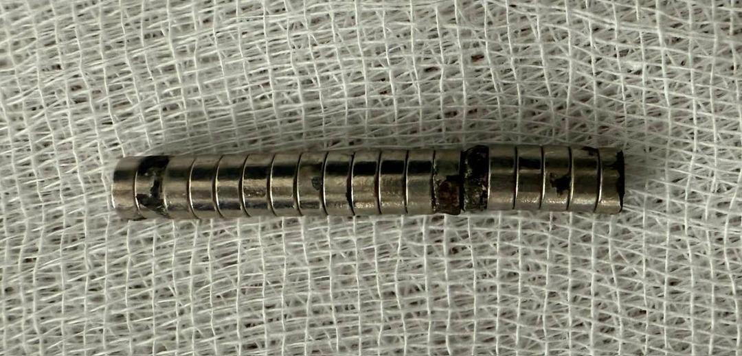 Hepsi boğazından çıktı: Tam 19 tane! Aman dikkat... Çocuklardan uzak tutun 3