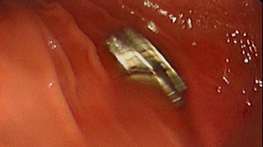 Hepsi boğazından çıktı: Tam 19 tane! Aman dikkat... Çocuklardan uzak tutun