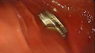 Hepsi boğazından çıktı: Tam 19 tane! Aman dikkat... Çocuklardan uzak tutun