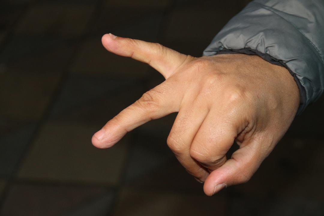 İade etmek istediği balıklarla dövdüler! Parmağını kaybetti 3