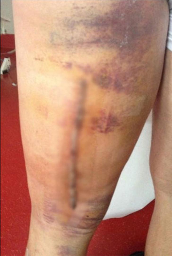 Pepe sonunda isyan etti! G1