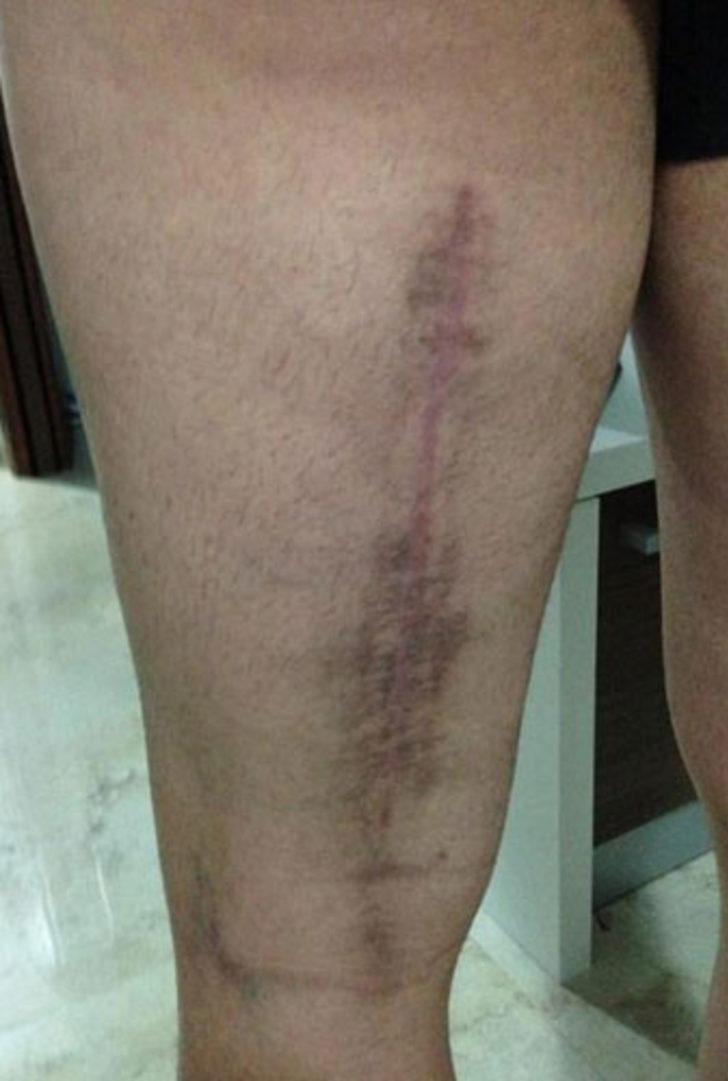 Pepe sonunda isyan etti! G2