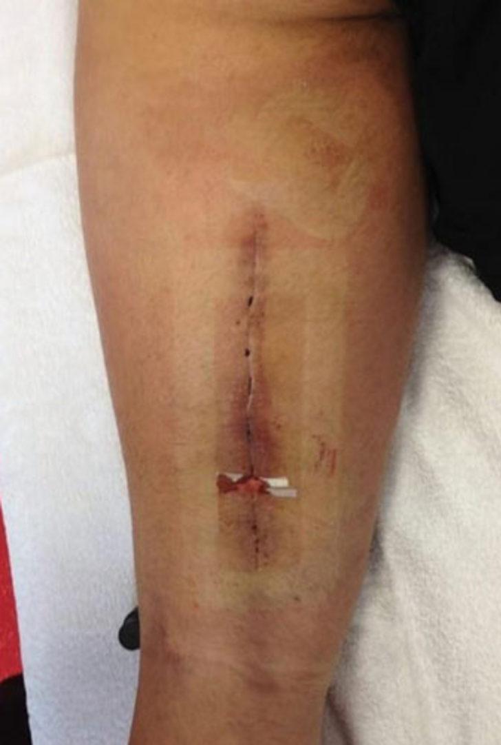 Pepe sonunda isyan etti! G3