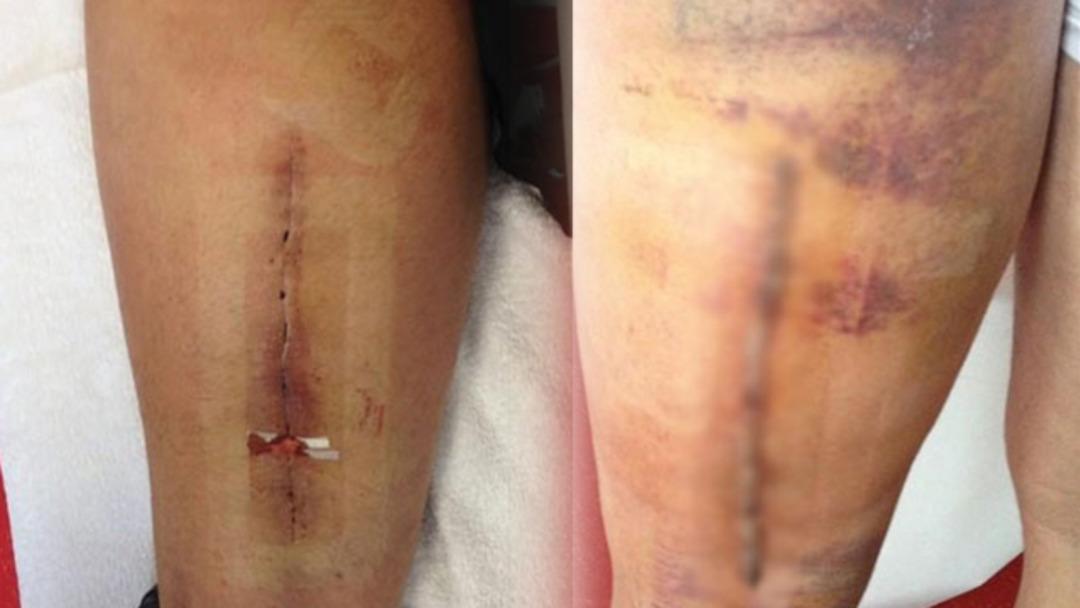 Pepe sonunda isyan etti!