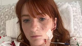 Doğumdan kısa süre sonra çay içti, hayatı kabusa döndü! Gözlerini bantlayarak uyuyor...