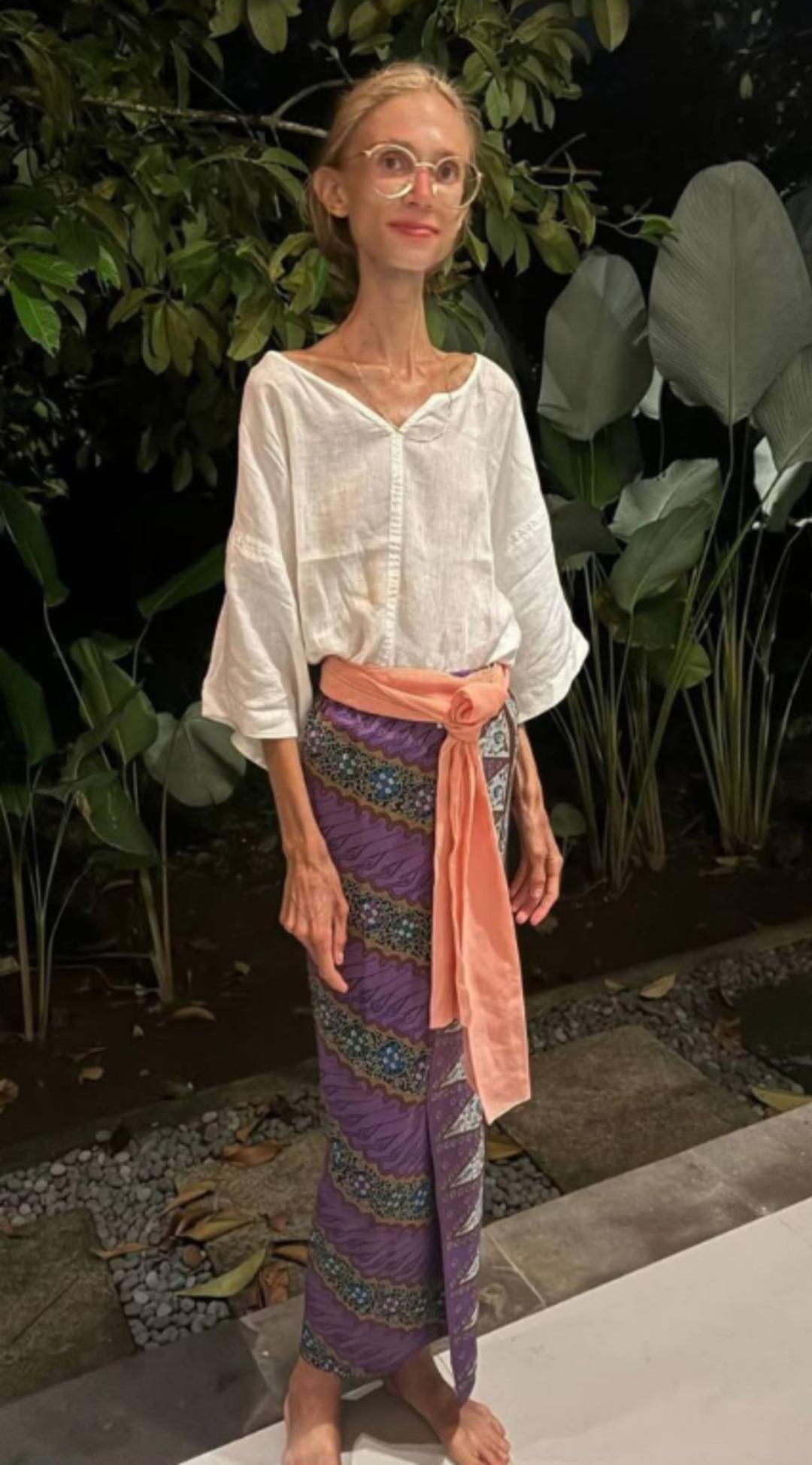 22 kiloya kadar düştü! Sosyal medya fenomeninin son hali yürek burktu: Sadece o diyeti yaparak... 1