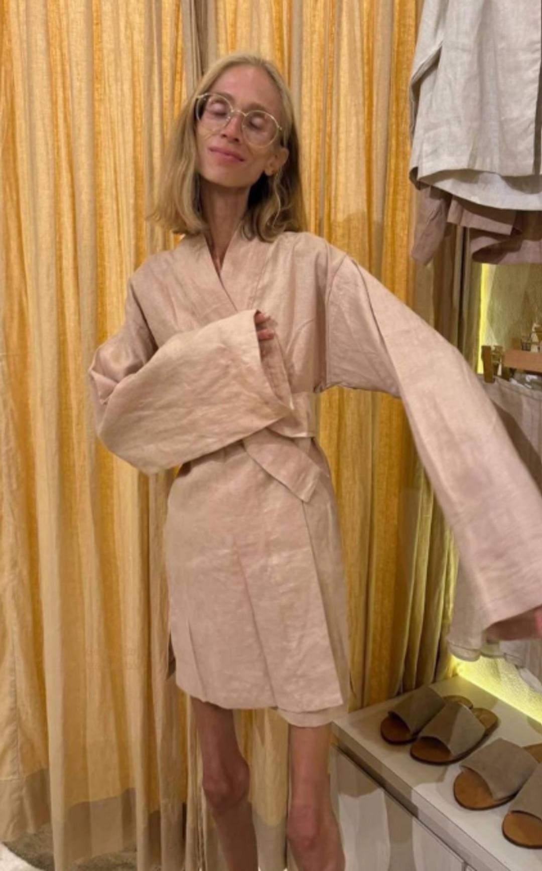 22 kiloya kadar düştü! Sosyal medya fenomeninin son hali yürek burktu: Sadece o diyeti yaparak... 3