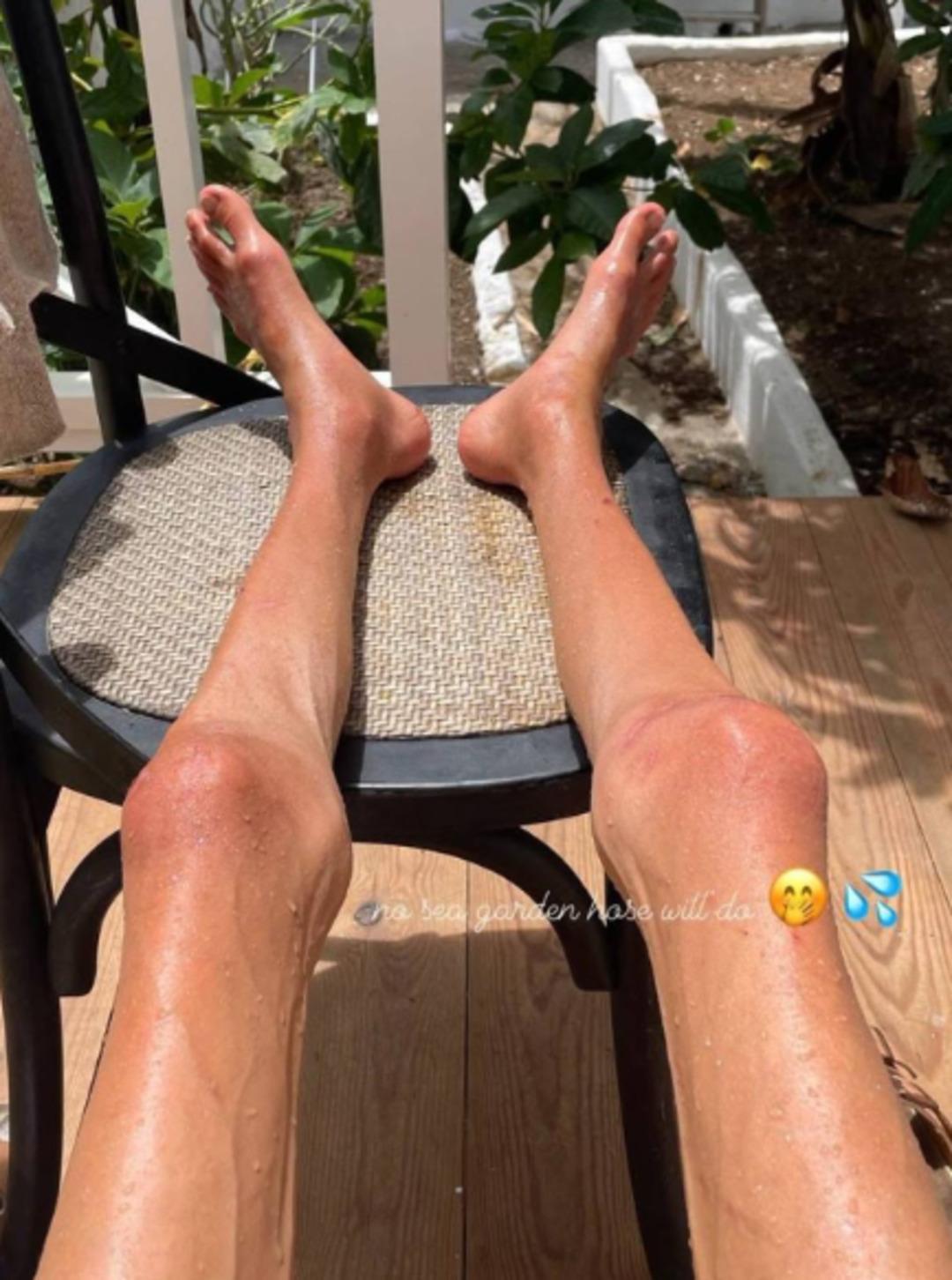 22 kiloya kadar düştü! Sosyal medya fenomeninin son hali yürek burktu: Sadece o diyeti yaparak... 2