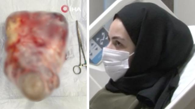 Karın şişliğinin diyetle geçeceğini sandı: 'Gazdır' dediler, 5 kiloluk dev kist çıktı! 