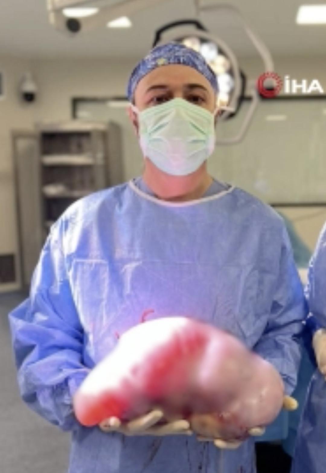 Karın şişliğinin diyetle geçeceğini sandı:  Gazdır  dediler, 5 kiloluk dev kist çıktı!  2