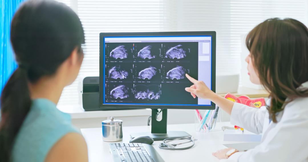 Her 7 kadından 1’ini etkiliyor: Doğurganlığı ciddi oranda tehdit ediyor! Şiddetli adet ağrılarınız varsa dikkat! Çikolata kisti nedir? 3