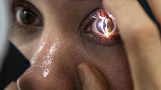 Göz sağlığı şansa bırakılmaz! Doğumdan itibaren düzenli takip edilmelidir! Uzman isim uyardı...