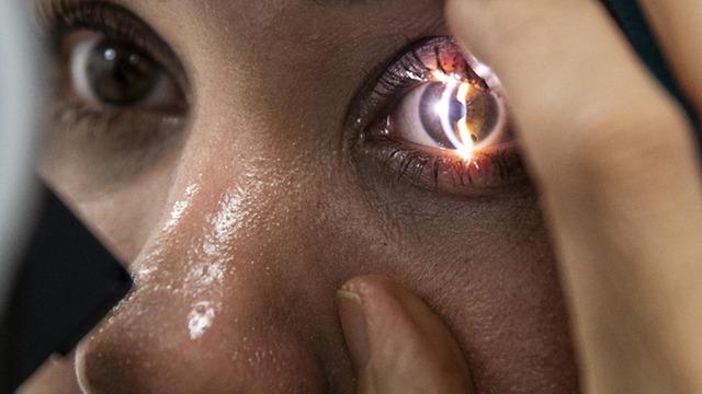 Göz sağlığı şansa bırakılmaz! Doğumdan itibaren düzenli takip edilmelidir! Uzman isim uyardı...