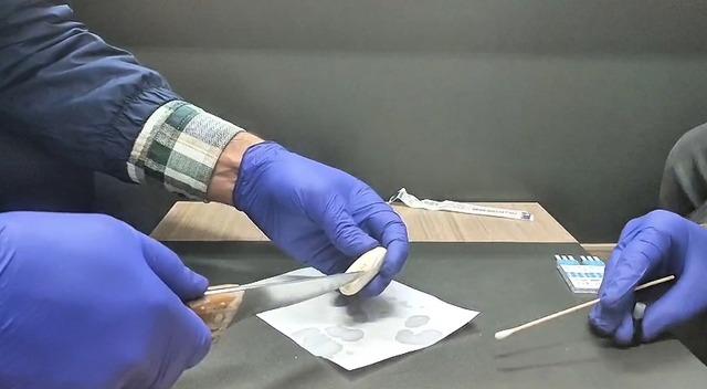 İranlı şüphelinin mide ve bağırsağından uyuşturucu çıktı 3