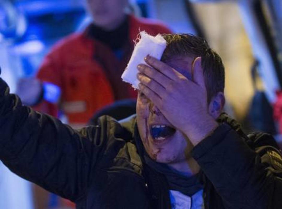 Ma&ccedil; başlamadan kan aktı