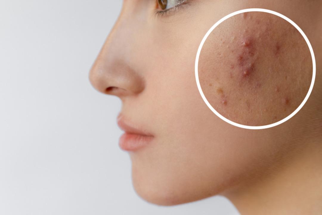 Lekeler, kuruluk, ince çizgiler… Cildiniz alarm veriyor olabilir: "Sonbahar cilt yenilenmesi için en uygun zaman" 4