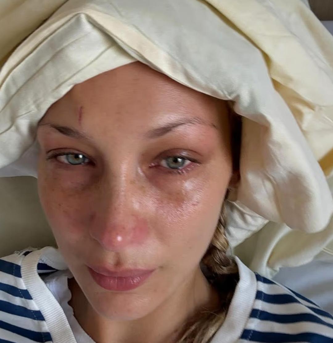 Zor zamanlar geçiriyordu! Bella Hadid ru halini açık açık anlattı 2