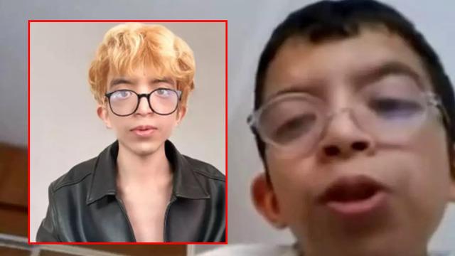 Tablet Reis Onurcan Güzel zorbalığa daha fazla dayanamadı! 5 ayrı yüz ameliyatı oldu