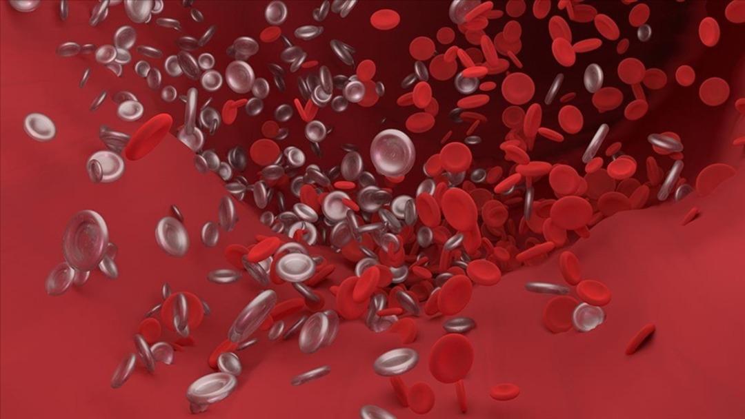 The most insidious and deadly disease of the modern age: 30,000 people die from thrombosis every year in Türkiye! 4