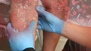 Modern çağın en sinsi ve ölümcül hastalığı: Türkiye'de her yıl 30 bin kişi tromboz nedeniyle hayatını kaybediyor! 