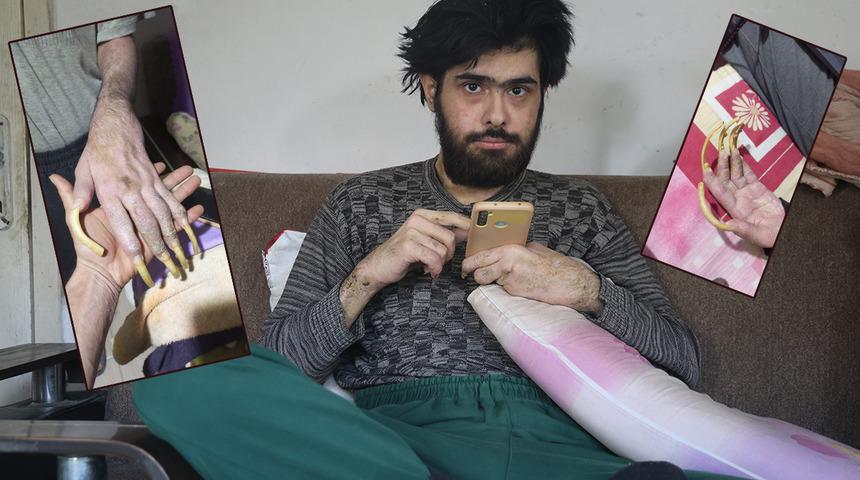 Okul birincisiydi telefona bağımlı hale geldi! 3 yıldır evden çıkmıyor: Duş almıyor, tırnaklarını kesmiyor